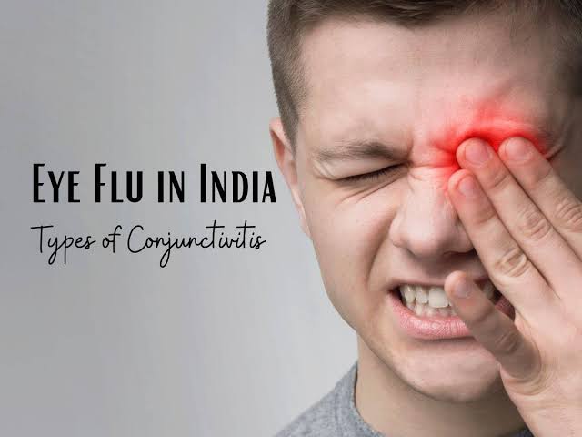 Worried about EYE FLU ? Do this to boost your Immunity